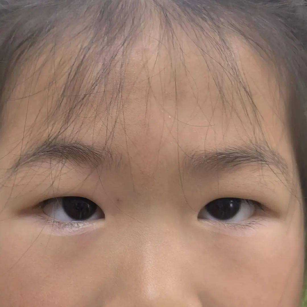 爱眼护眼,守护"视"界