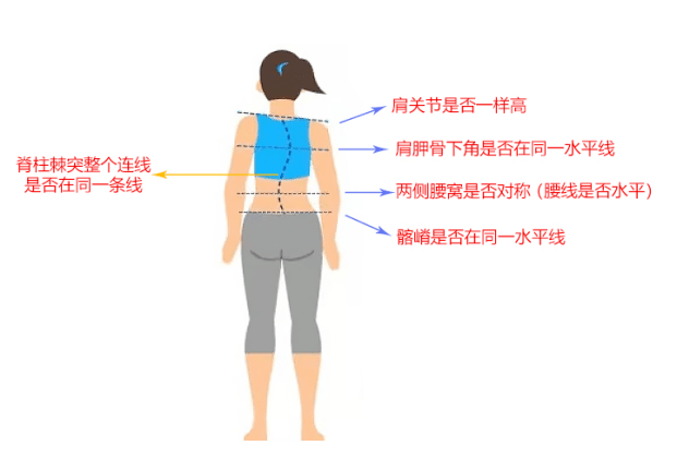 是否对称;④髂嵴是否在一条线上⑤脊柱棘突整个连线是否在一条线上