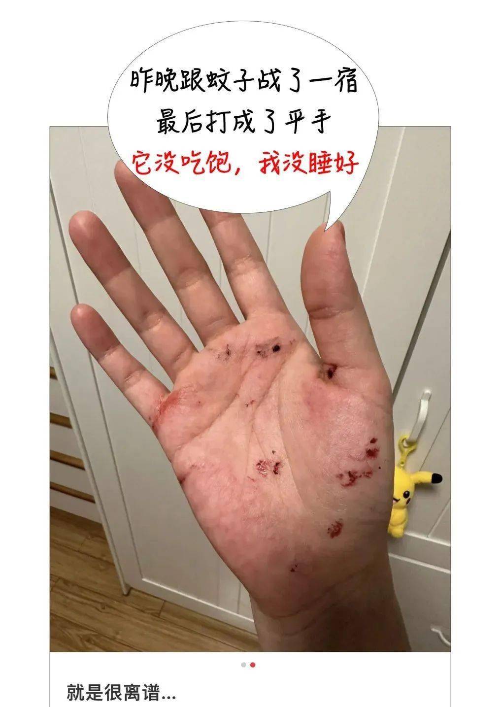 蚊子吸血时拍死它,会更痒?_百色_教育_内容