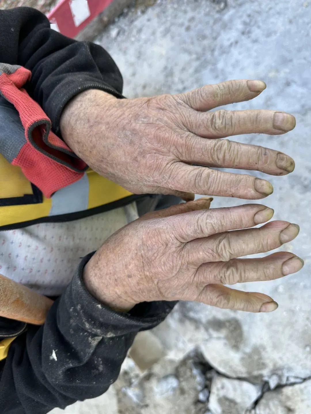 这是关于"一双手"的故事_工作_生活_项目