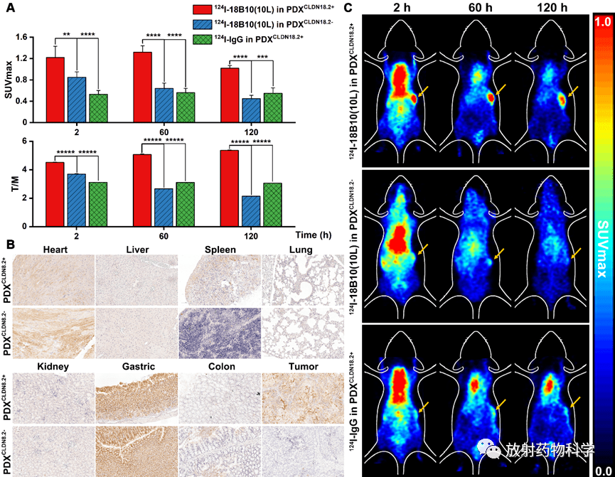 (10l),并通过小动物pet显像和大鼠组织切片ihc初步确定了探针的特异性