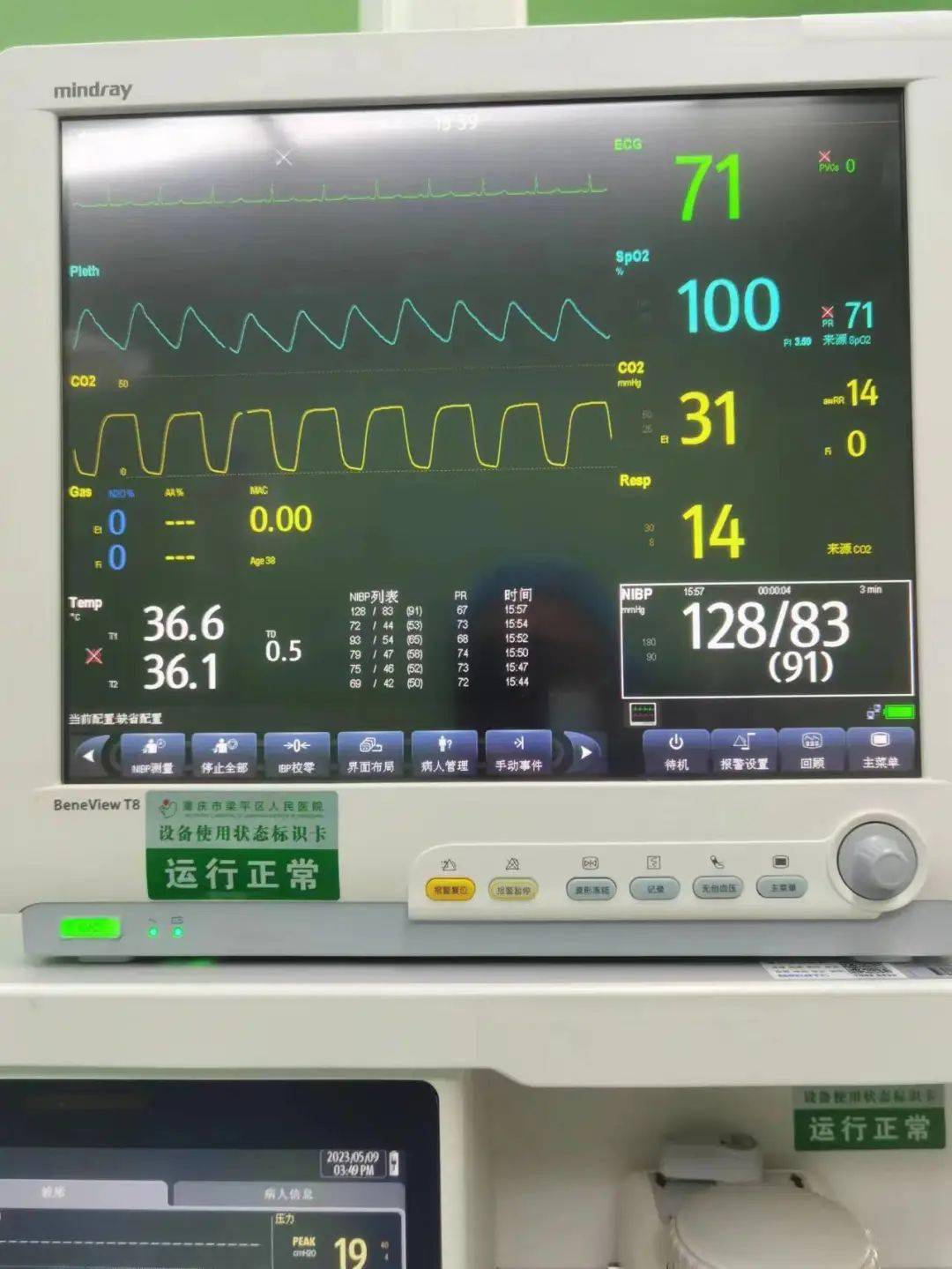 满满干货:如何显著降低全麻病人术中低体温发生率?