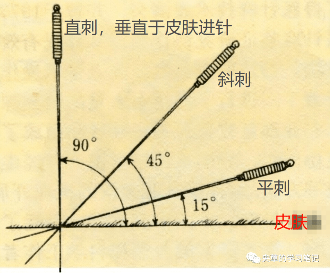 针头斜面向上的图片图片