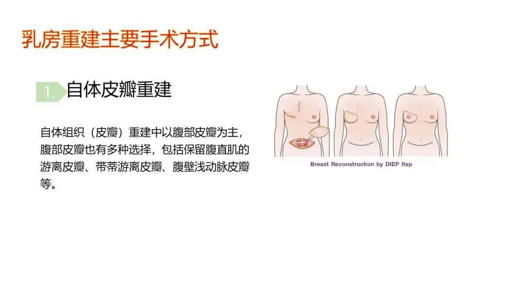 二期自体乳房重建丑图片