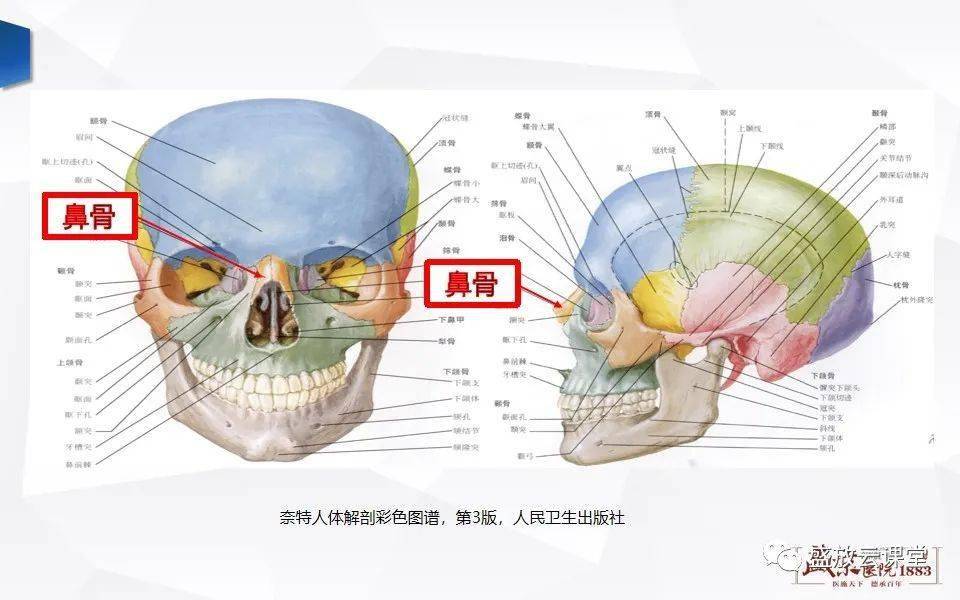 鼻骨正常ct解剖