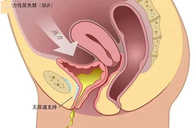 患者擺脫