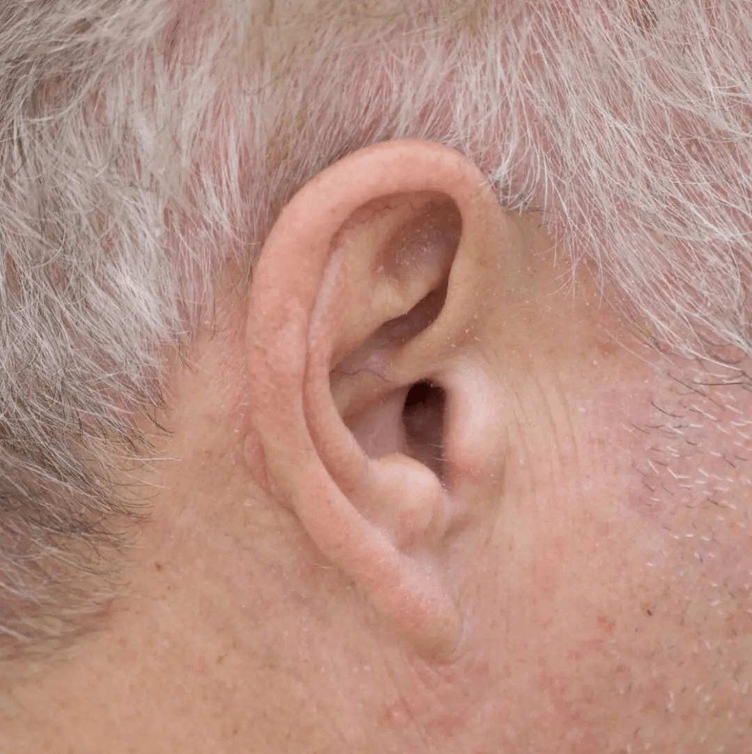 冠心病发作前可能出现这3个"特征",掌握后或许可减少