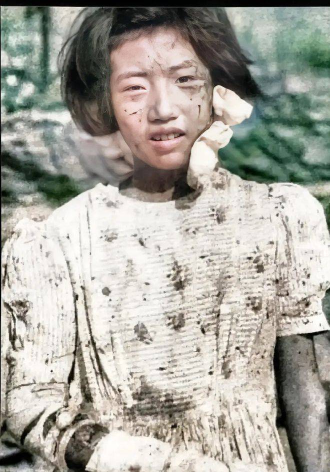 1945年,广岛原子弹轰炸后一名幸存女孩照片,眼神迷茫地望向镜头
