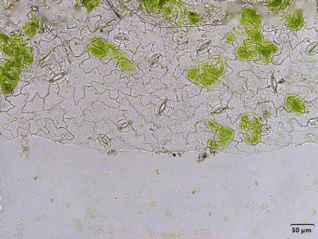 菠菜表皮细胞图片
