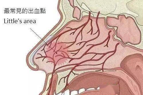 正确止鼻血方法看这里!_鼻腔_家长_检查