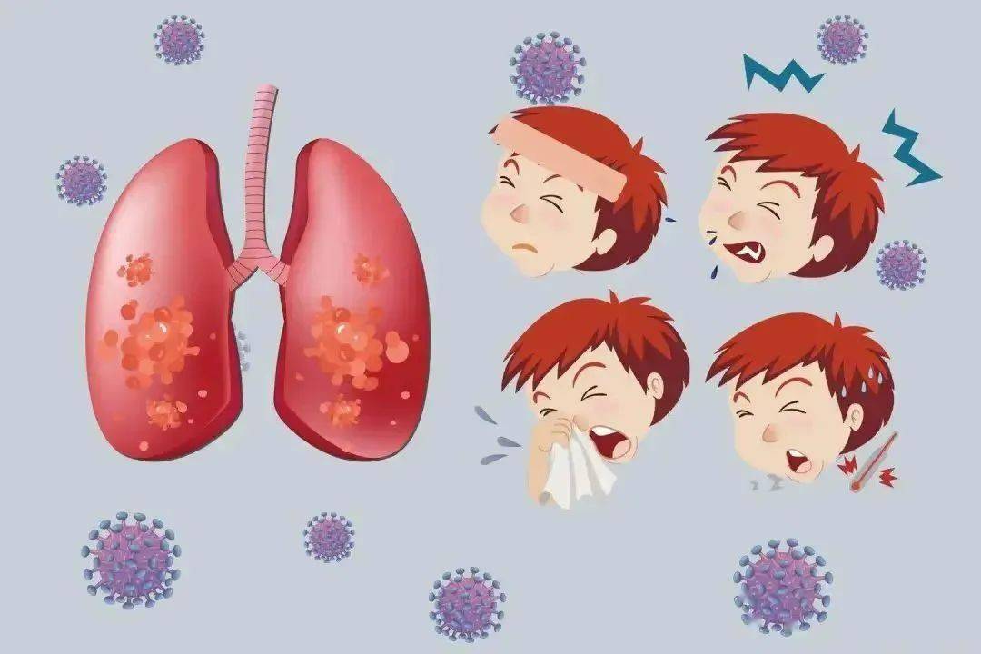 国内出现偏肺病毒感染,人类偏肺病毒是什么?_传播_症状_呼吸道