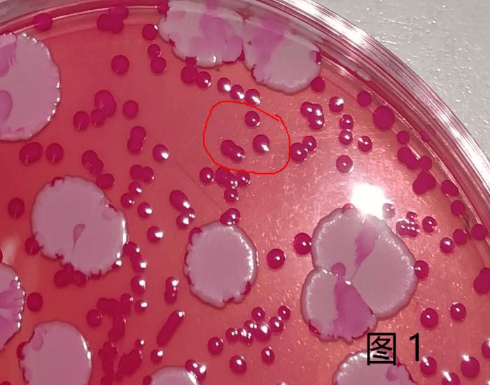霉菌和酵母检测怎么鉴定?标准方法与快检有哪些不同?_菌落_琼脂_时间