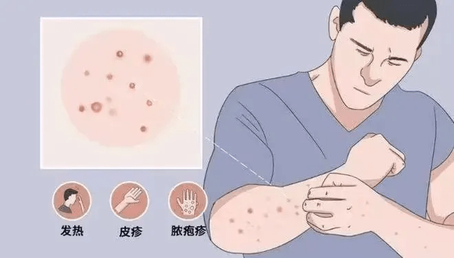 山羊痘病毒图片