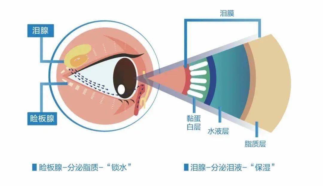 "干眼症"也叫"角结膜干燥症",是因为泪水总量不足,不能够维持眼球表面