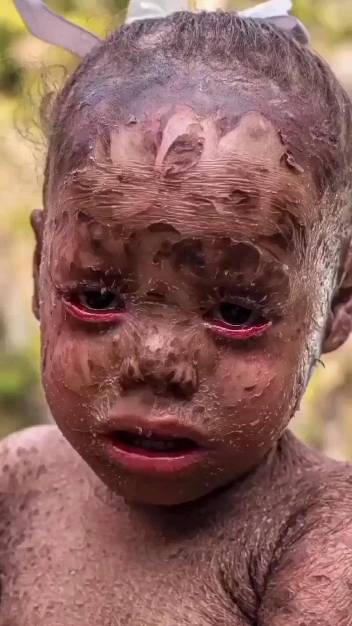 这个世界有很多地方依然贫穷!