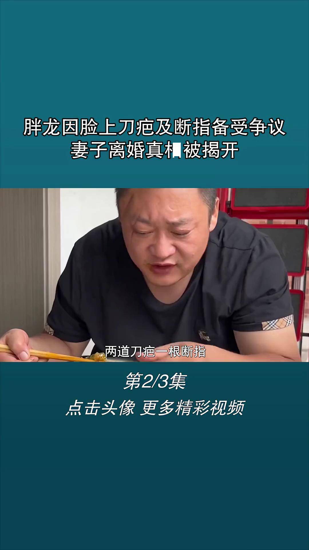 胖龙因脸上刀疤及断指备受争议,妻子离婚真相被揭开