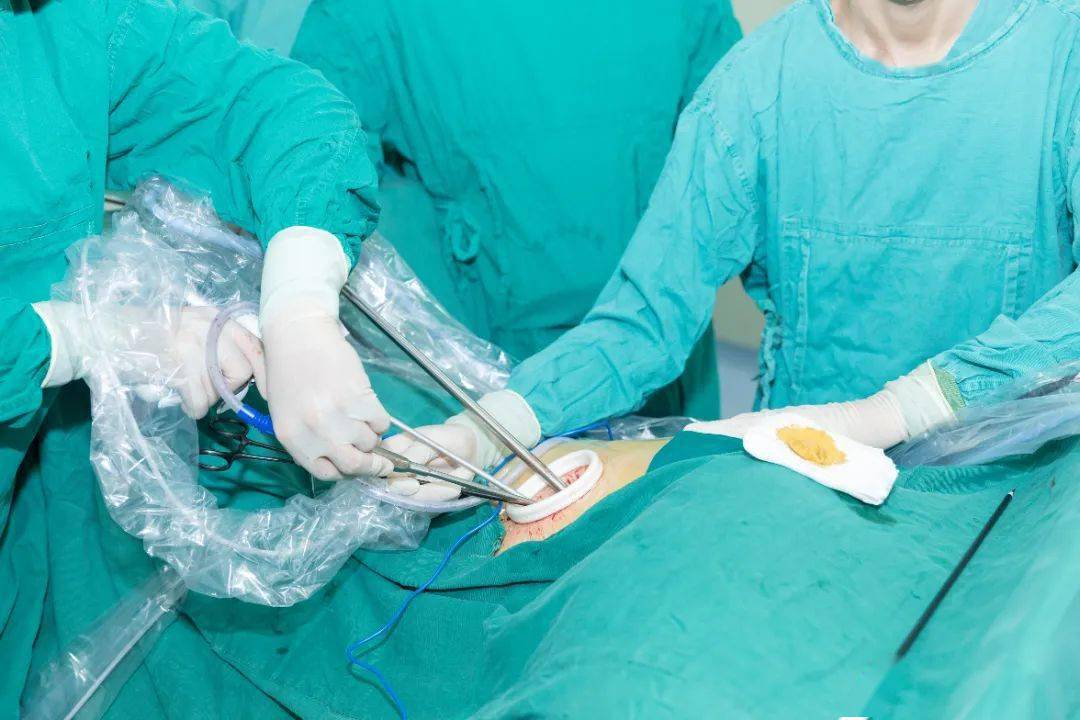 定理微创医学学术周90 | 胸外科分论坛完美谢幕_手术_直播_温州市