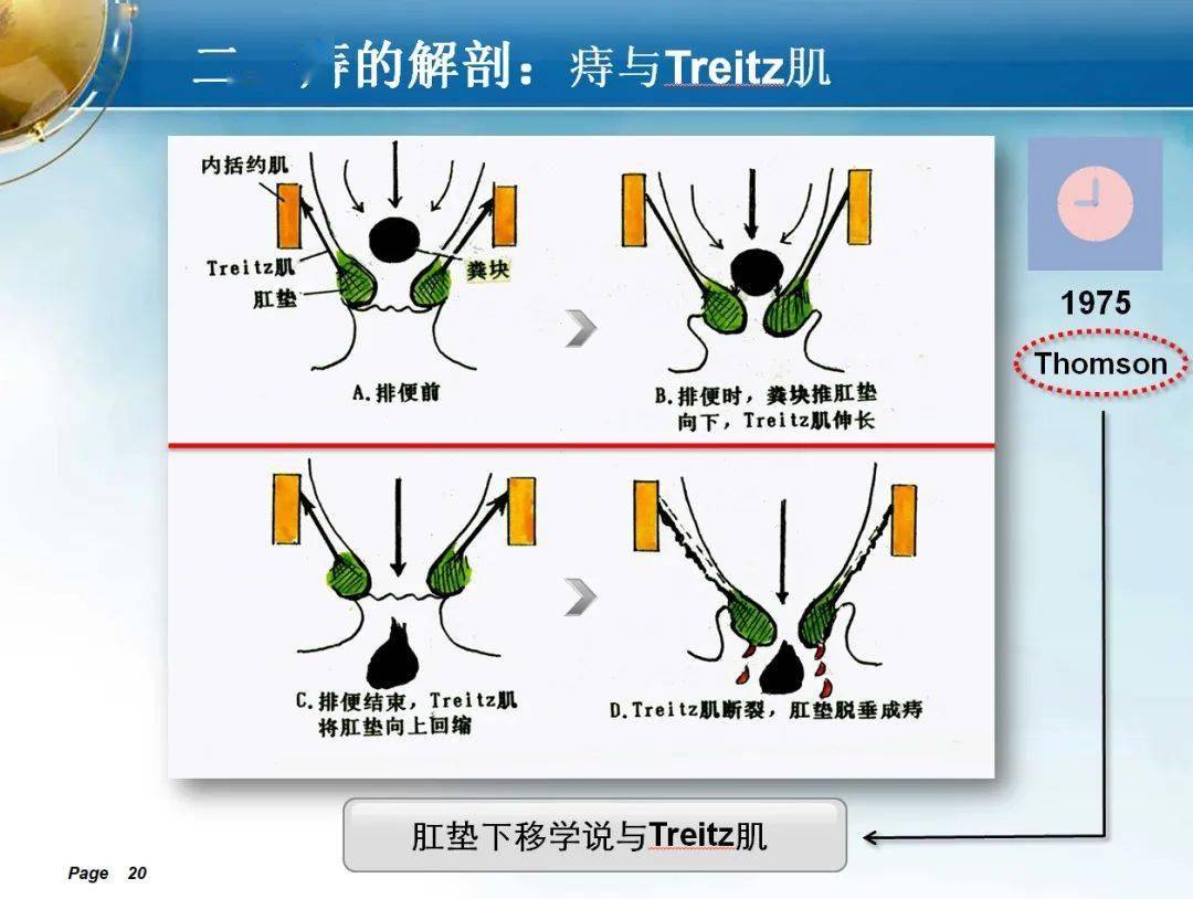 会场速递|痔的应用解剖学机制探讨_中医药学会_中华_肛肠