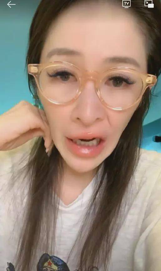 近几年年萧亚轩专注于谈恋爱,再加上脸被狗咬了,进行了修补美容整形