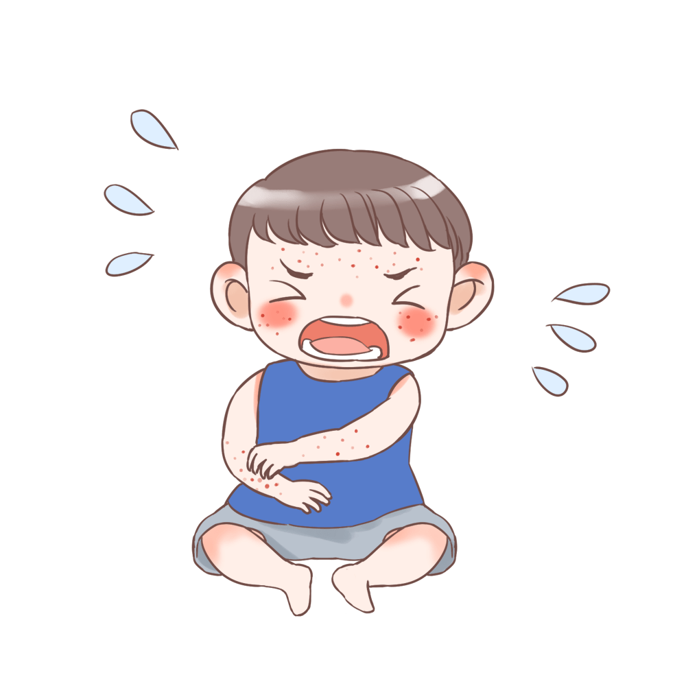 湿疹和痱子分不清?教你1招轻松辨别