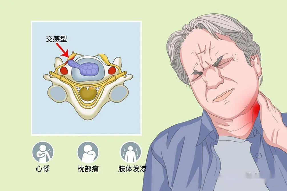 颈椎病的 6 种分型及特点