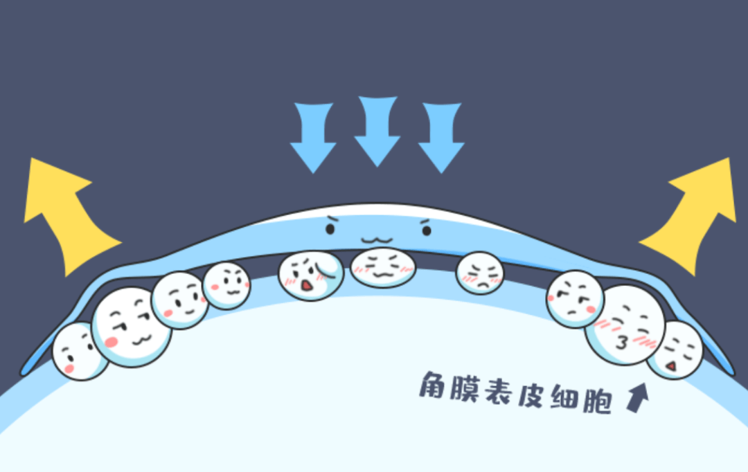 【新手必知33问】角膜塑形镜知多少_眼睛_镜片_爱情