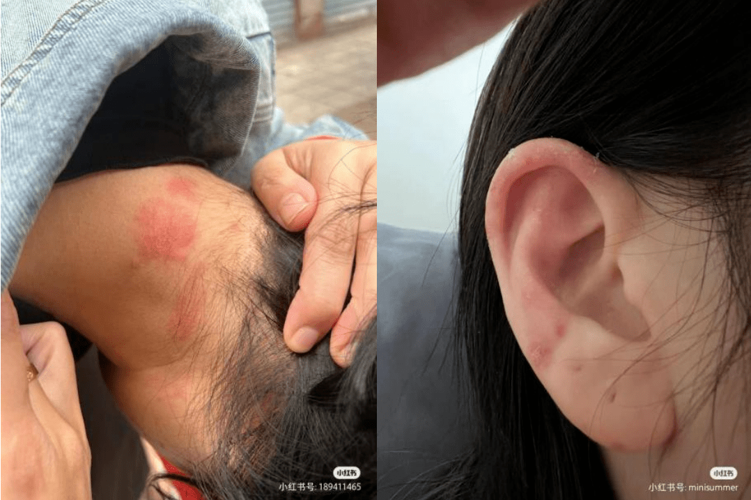 染发剂中的对苯二胺,会导致皮肤过敏,甚至致癌.