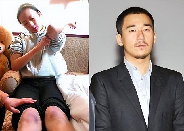 身为一个女演员,童谣自然是要保持身材纤细的,而张默整整比她高了一头