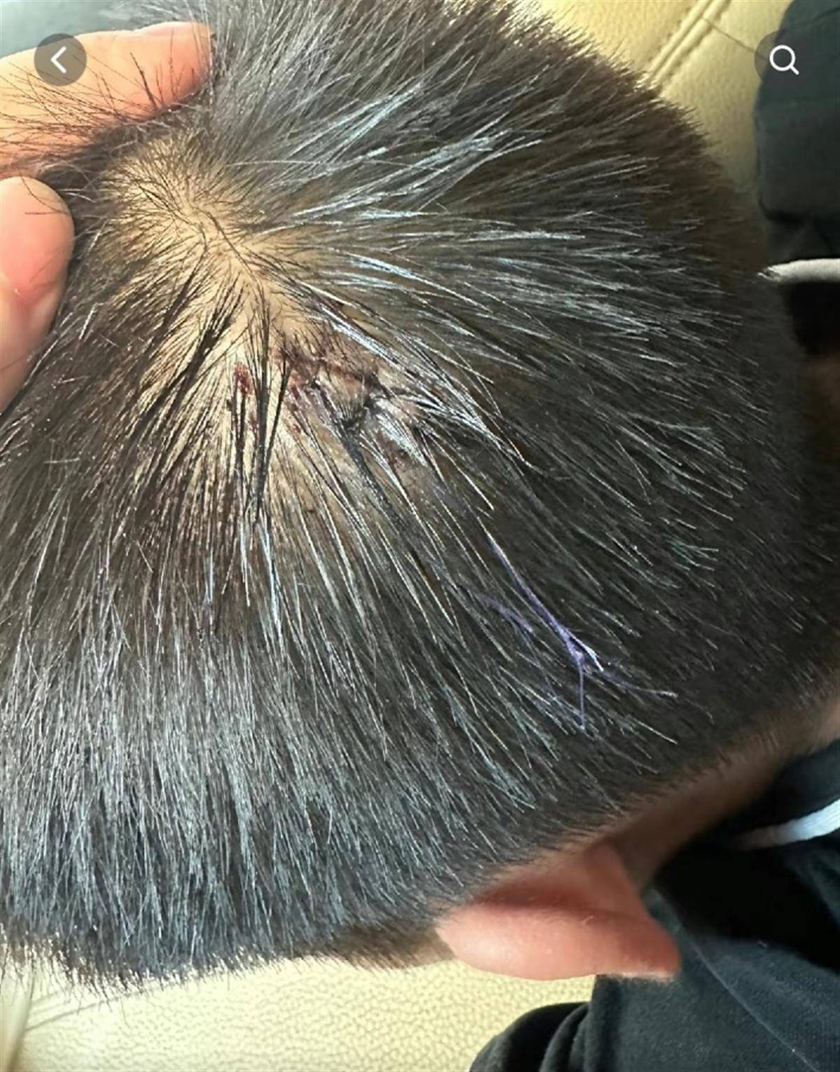 男孩被跆拳道教练踢到后头部撞墙受伤,校方:非故意伤