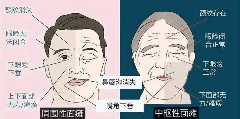 嘴歪眼斜卡通图片