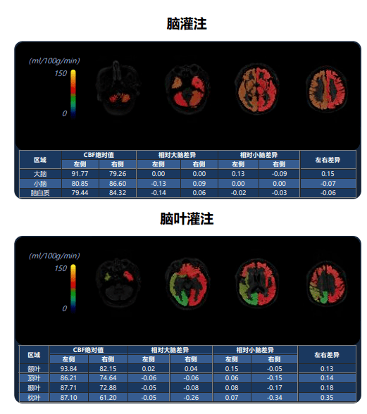 脑灌注成像颜色解读图片