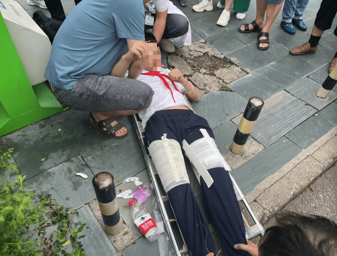 黔东南一县小学生过斑马线被出租车撞飞致双腿骨折,路人:"车未减速" !