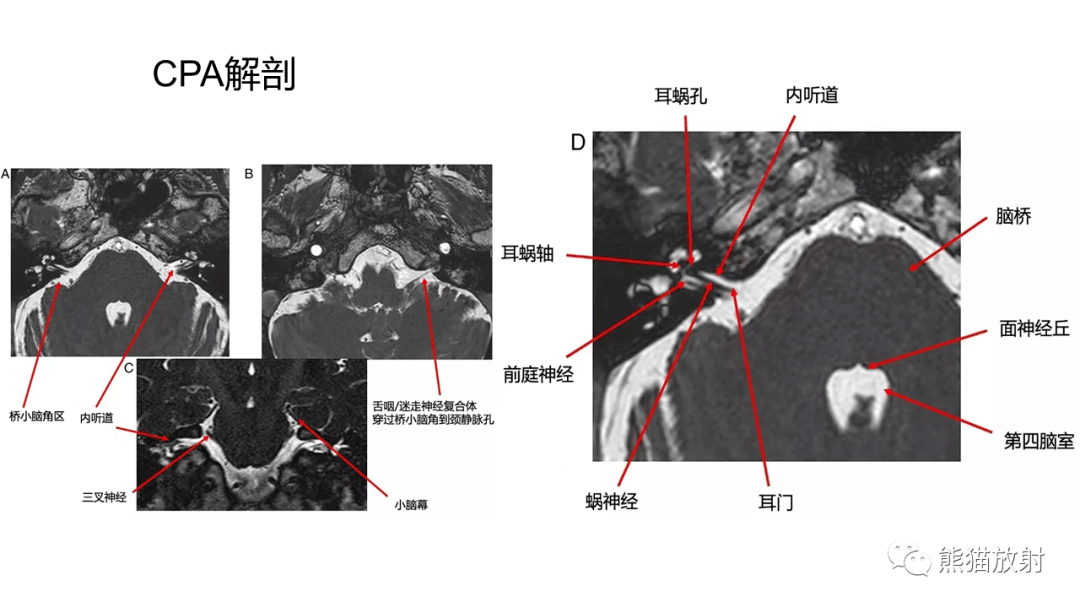 桥小脑角区解剖彩图图片