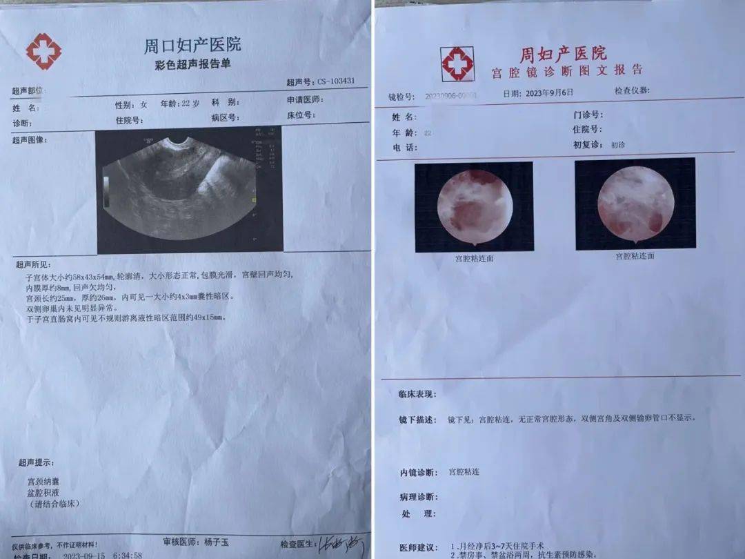 输卵管报告单图片图片