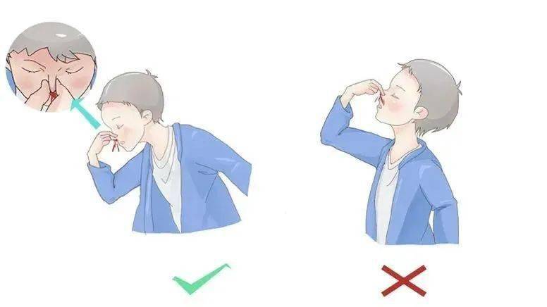 一文教你正确止血方法!_孩子_鼻腔_家长