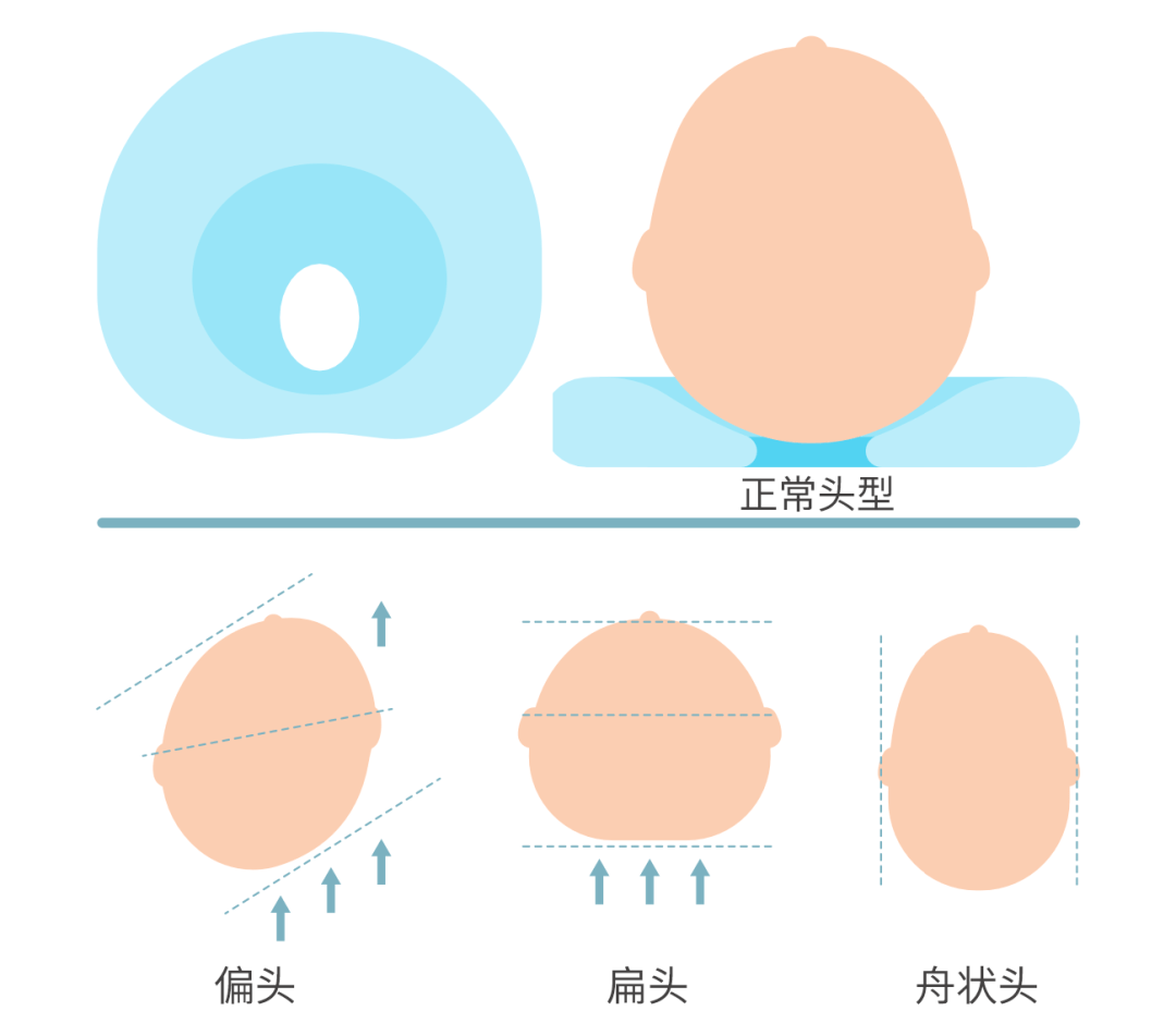 头型_时候_形状