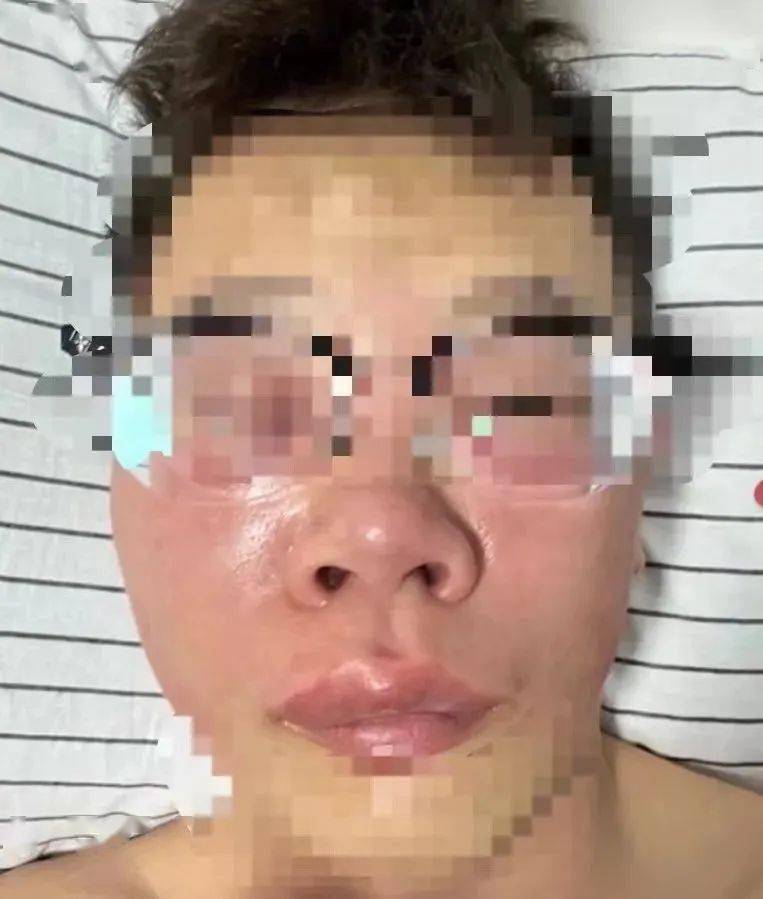 经常挖鼻孔的好处,只有这一个_鼻子_鼻腔_面部