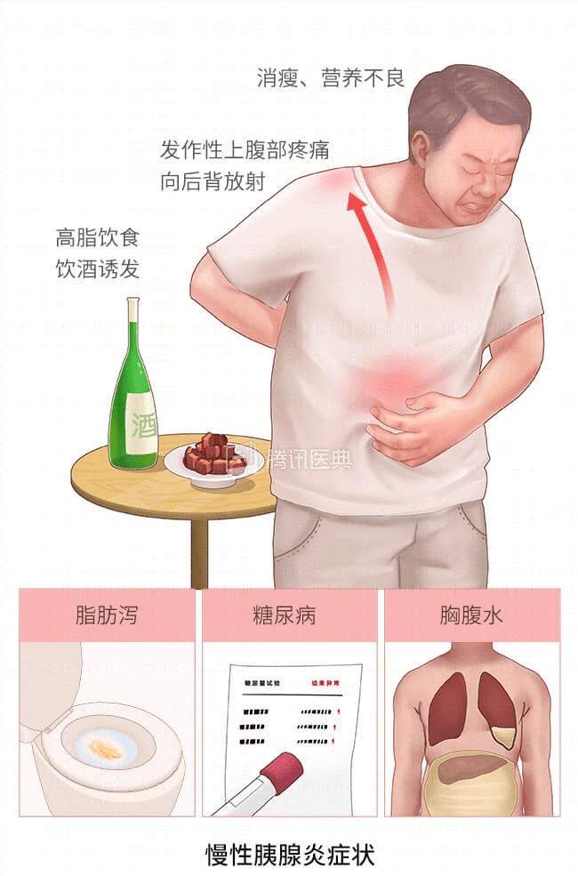 胰腺炎脂肪泻图片