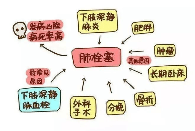 骨折孕妇遇上"肺栓塞",晋城大医院变身"拆弹专家"!_治疗_进行_李女士