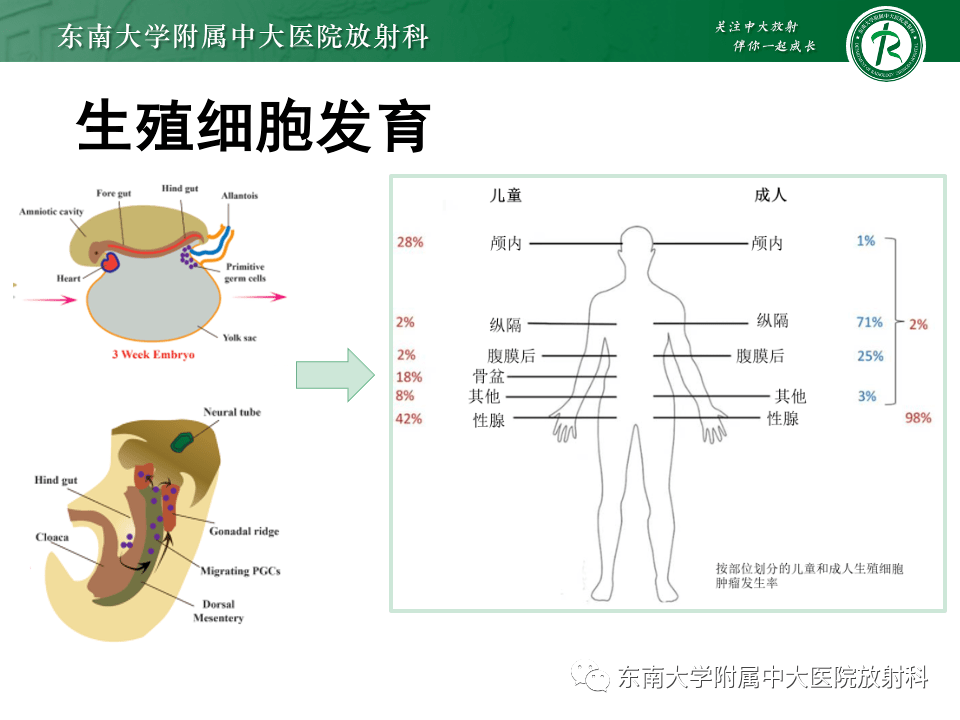 睾丸生殖细胞肿瘤的影像诊断