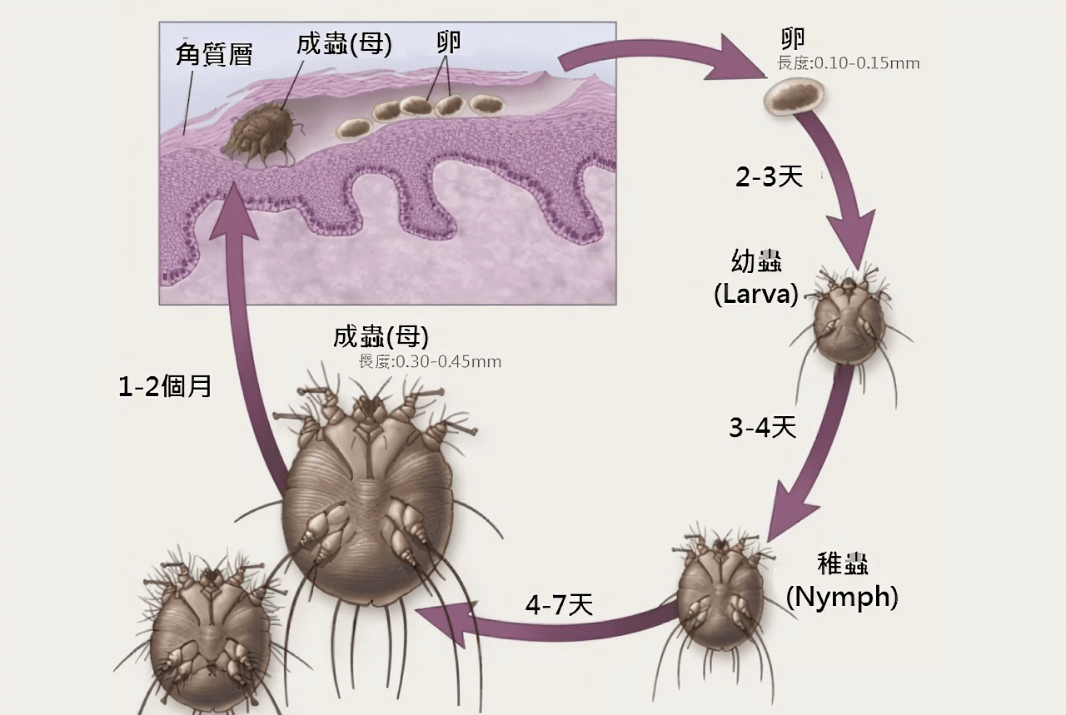 丁女士_疥虫_皮肤