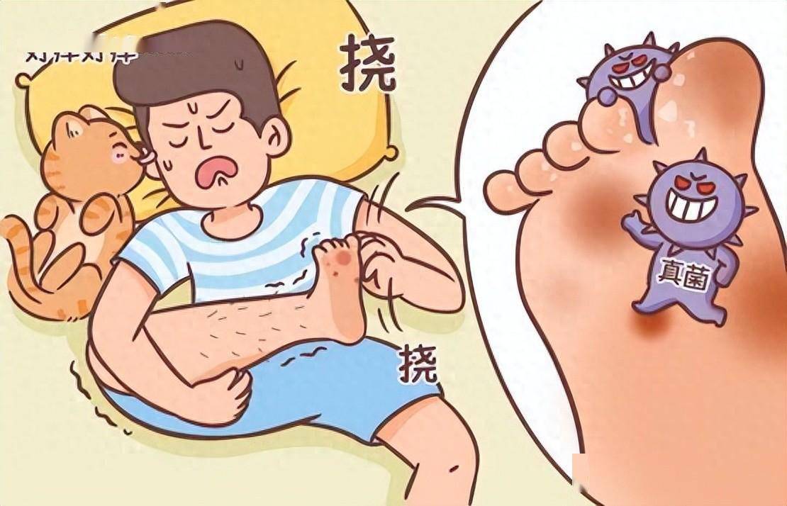 "痛"竟比"痒"舒服!这种感觉,会跟随一辈子吗?_皮肤_水疱_鳞屑