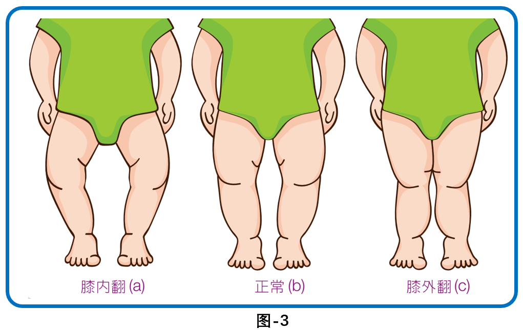 4种儿童常见的"异常步态"(检查及治疗)_关节_运动_患者