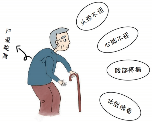 老年人要注意驼背,危害很多!_影响_脊柱_肌肉