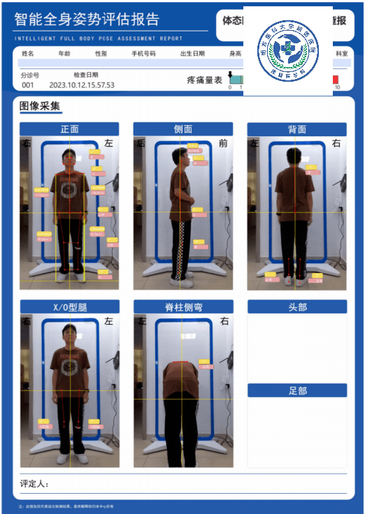 体态姿势也能评估?我院康复医学科上新