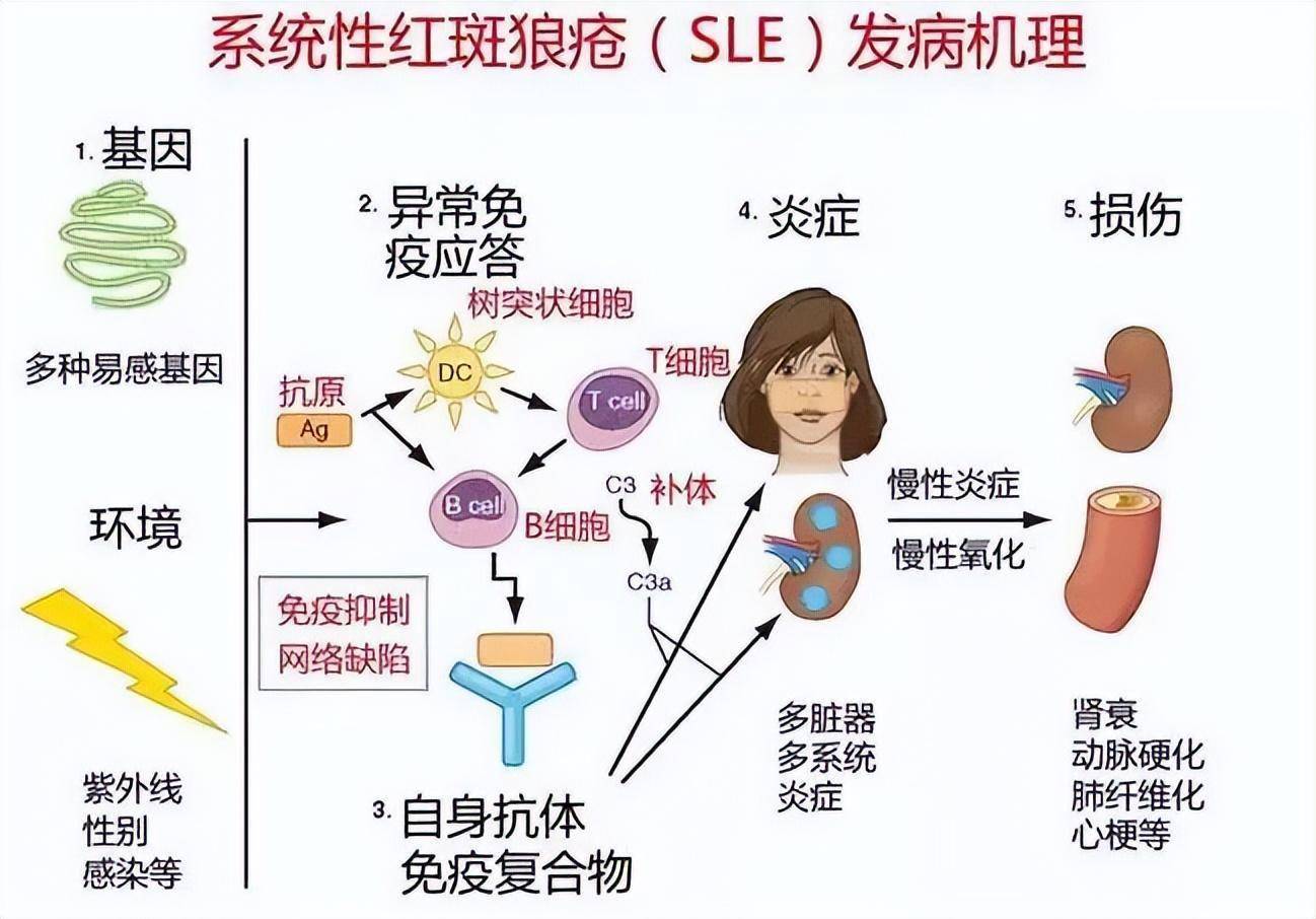 目前系统性红斑狼疮的病因尚不清楚.