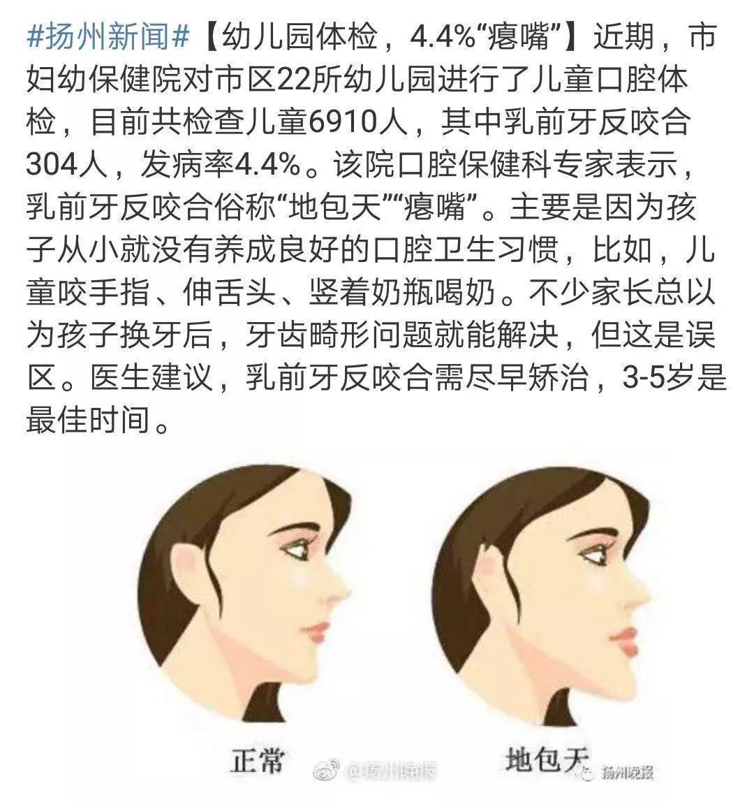 孩子啃指甲,咬鉛筆,咬被角……這些小細節,千萬別忽視_東西_父母_心理