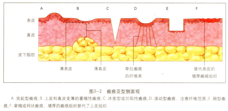 治療_方式_兒童