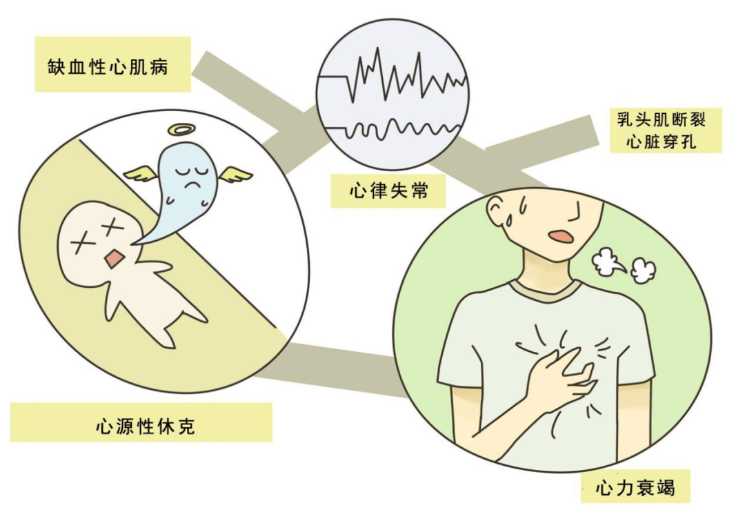 虽然急性心肌梗死典型症状是突然剧烈的胸痛