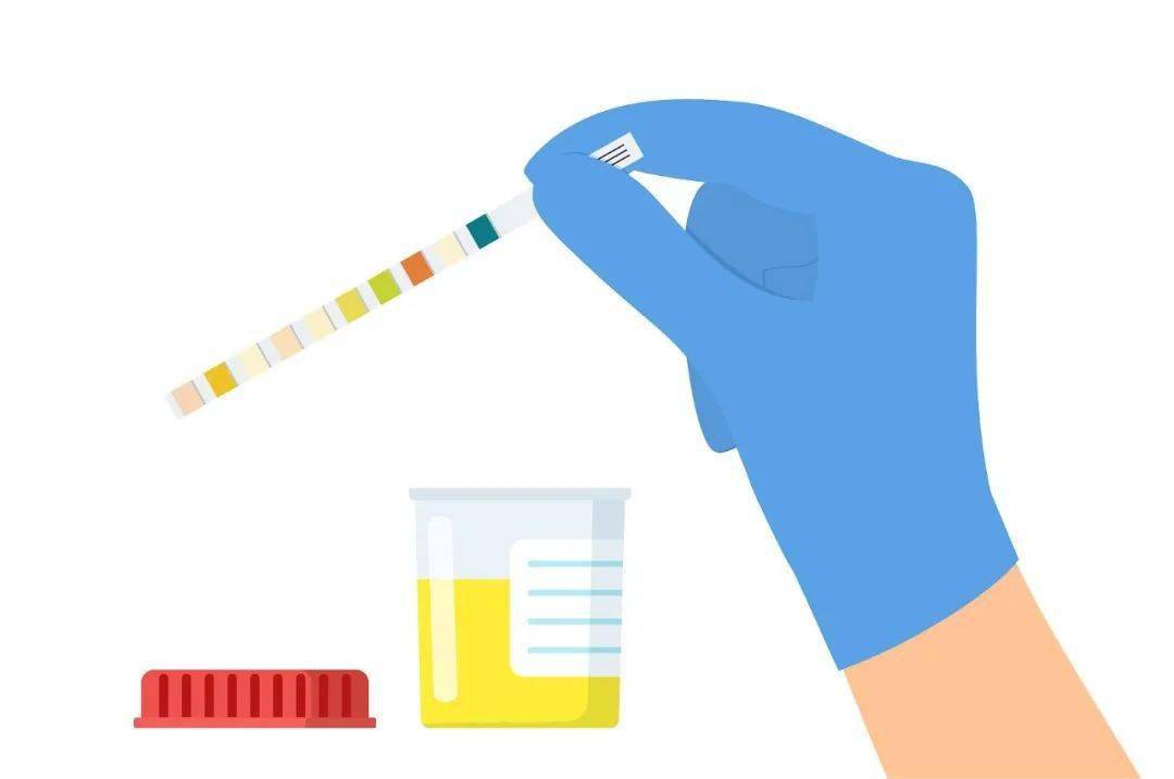 尿液检验报告单图片